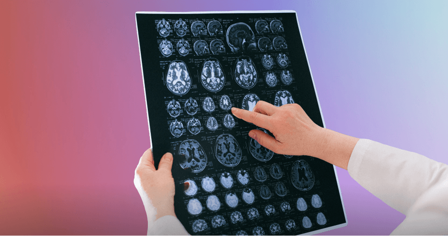 Brain Health Blog (1)